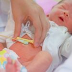 Coto umbilical: o que é e como cuidar do umbigo do recém-nascido