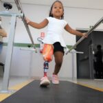 Menina de 3 anos caminha pela primeira vez após ganhar prótese sob medida no Tocantins
