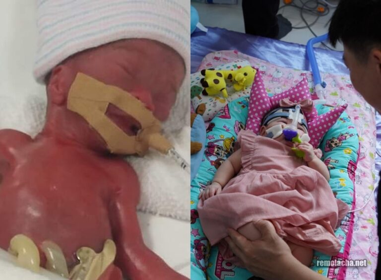 Menor bebê prematuro do mundo recebe alta após 13 meses na UTI