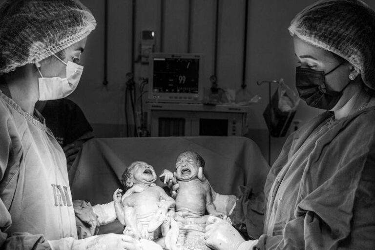 Parto de trigêmeas idênticas emociona em hospital de Marabá