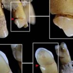 Mulheres de cultura da idade do bronze usavam dentes como ferramentas