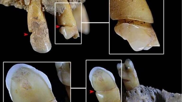 Mulheres de cultura da idade do bronze usavam dentes como ferramentas