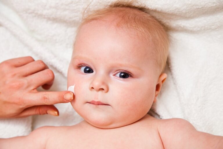 Como tratar picadas de inseto em bebês