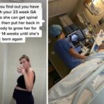 Feto é operado dentro do útero