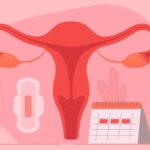 As diferenças entre menstruação escura, escape menstrual e sangramento de ovulação
